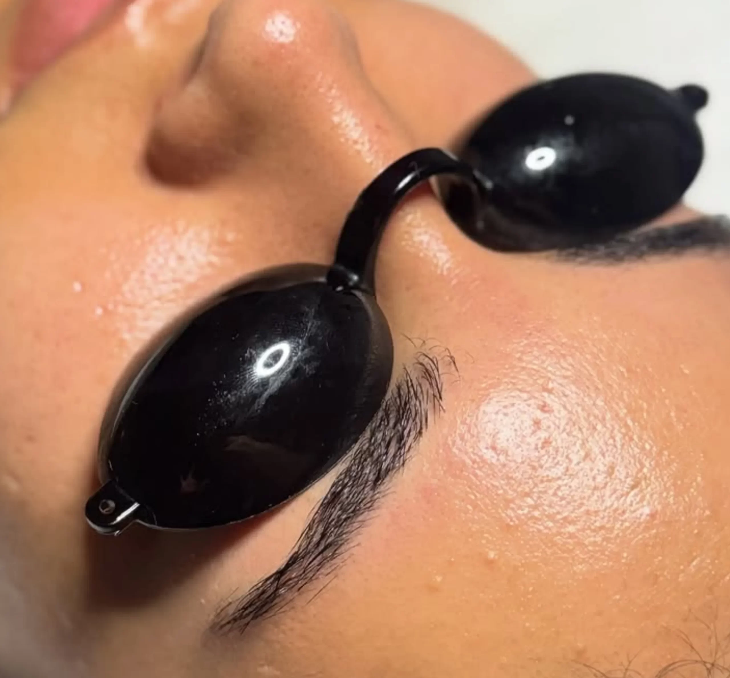 facial treatments Brisbane